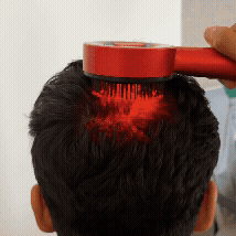 Massage Your Scalp